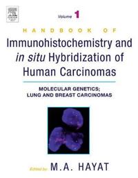 Handbook of Immunohistochemistry and in Situ Hybridization of Human Carcinomas