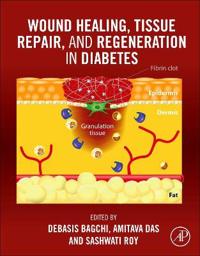 Wound Healing, Tissue Repair, and Regeneration in Diabetes