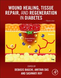 Wound Healing, Tissue Repair, and Regeneration in Diabetes