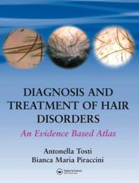 Diagnosis and Treatment of Hair Disorders