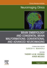 Brain Embryology and the Cause of Congenital Malformations, An Issue of Neuroimaging Clinics of North America