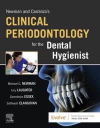 Newman and Carranza's Clinical Periodontology for the Dental Hygienist