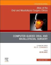 Guided Oral and Maxillofacial Surgery, An Issue of Atlas of the Oral & Maxillofacial Surgery Clinics
