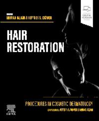 Procedures in Cosmetic Dermatology: Hair Restoration