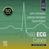 160 ECG Cases