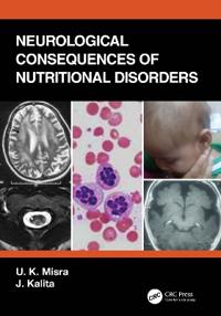 Bokomslag för "Neurological Consequences of Nutritional Disorders"