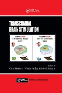 Bokomslag för "Transcranial Brain Stimulation"
