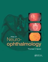 Bokomslag för "Atlas of Neuro-ophthalmology"