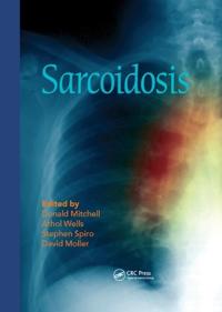 Bokomslag for "Sarcoidosis"
