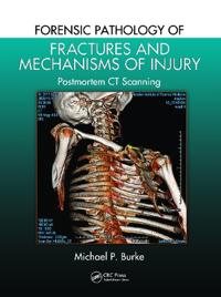 Bokomslag för "Forensic Pathology of Fractures and Mechanisms of Injury"