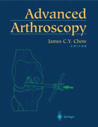 Advanced Arthroscopy