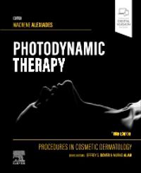 Procedures in Cosmetic Dermatology Series: Photodynamic Therapy