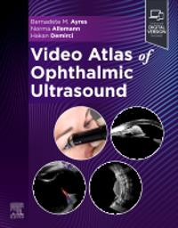 Video Atlas of Ophthalmic Ultrasound