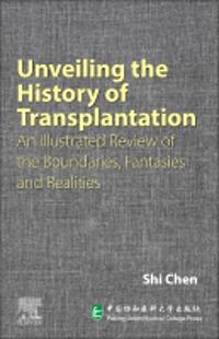 Unveiling the History of Transplantation