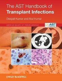 The AST Handbook of Transplant Infections