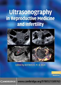 Ultrasonography in Reproductive Medicine and Infertility