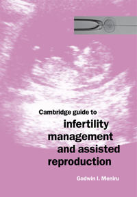 Bokomslag för "Cambridge Guide to Infertility Management and Assisted Reproduction"