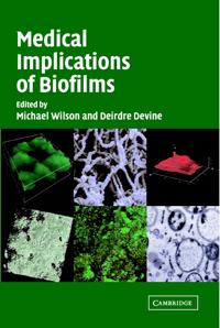 Bokomslag for "Medical Implications of Biofilms"