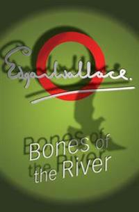 Bones