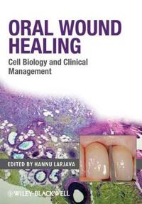 Oral Wound Healing