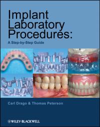 Implant Laboratory Procedures