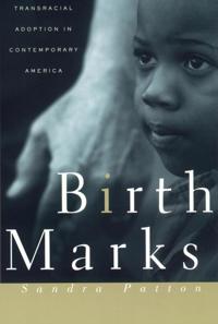 Bokomslag för "Birthmarks"