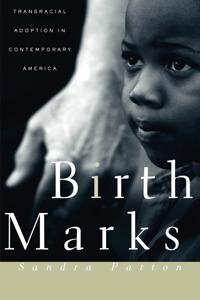 Birthmarks