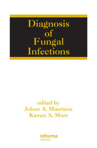 Diagnosis of Fungal Infections