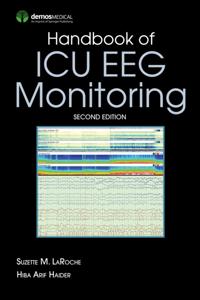 Handbook of ICU EEG Monitoring