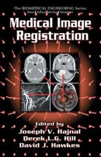 Bokomslag för "Medical Image Registration"