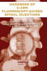 The Handbook of C-Arm Fluoroscopy-Guided Spinal Injections