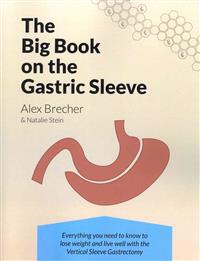 The Big Book on the Gastric Sleeve: Everything You Need to Know to Lose Weight and Live Well with the Vertical Sleeve Gastrectomy