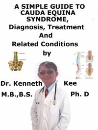 Simple Guide to Cauda Equina Syndrome, Diagnosis, Treatment and Related Conditions