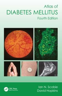Bokomslag för "Atlas of Diabetes Mellitus"
