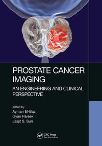 Bokomslag for "Prostate Cancer Imaging"