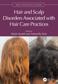 Bokomslag för "Hair and Scalp Disorders Associated with Hair Care Practices"