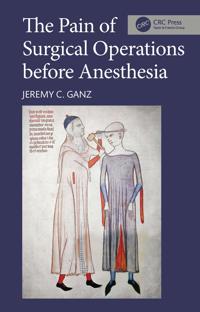 The Pain of Surgical Operations before Anesthesia