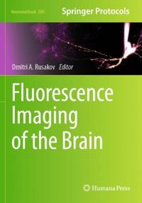 Fluorescence Imaging of the Brain