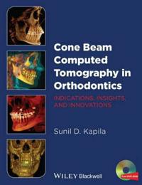 Cone Beam Computed Tomography in Orthodontics
