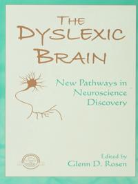 Extraordinary Brain Series