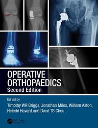 Bokomslag för "Operative Orthopaedics"