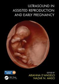 Bokomslag för "Ultrasound in Assisted Reproduction and Early Pregnancy"