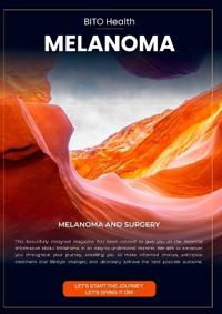 Melanoma