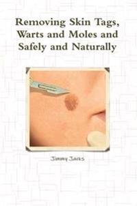 Removing Skin Tags, Warts and Moles and Safely and Naturally