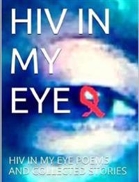 HIV in My Eye