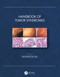 Handbook of Tumor Syndromes