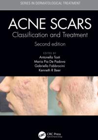 Series in Dermatological Treatment