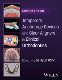 Temporary Anchorage Devices and Clear Aligners in Clinical Orthodontics