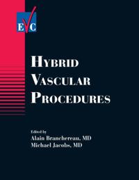 Hybrid Vascular Procedures