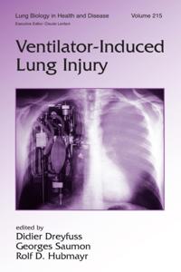 Lung Biology in Health and Disease